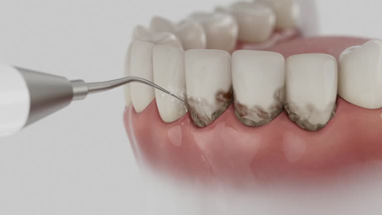 Trusted Root Canal Treatment service in Broadway, VA - Dentist Open Now